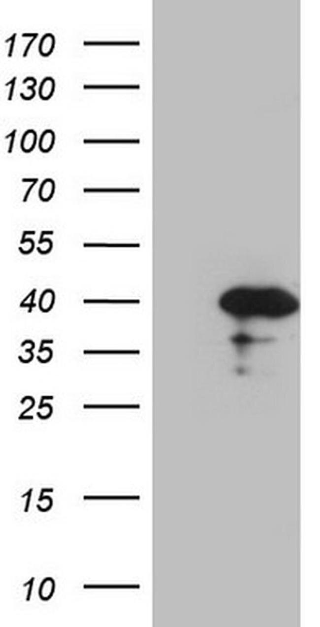 CDCA8 Antibody in Western Blot (WB)