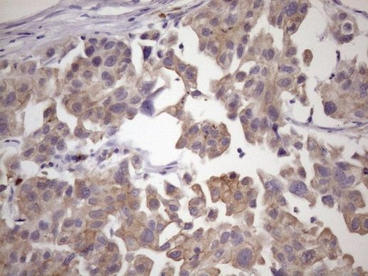 SMCP Antibody in Immunohistochemistry (Paraffin) (IHC (P))