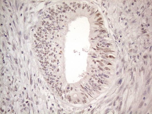 CtBP2 Antibody in Immunohistochemistry (Paraffin) (IHC (P))