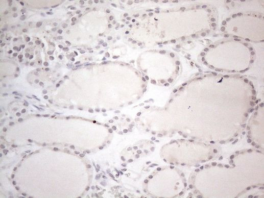 CtBP2 Antibody in Immunohistochemistry (Paraffin) (IHC (P))