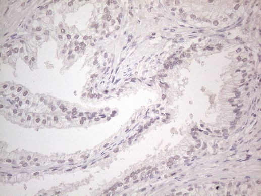 CtBP2 Antibody in Immunohistochemistry (Paraffin) (IHC (P))