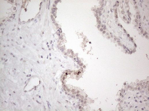 CtBP2 Antibody in Immunohistochemistry (Paraffin) (IHC (P))