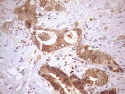 ASB2 Antibody in Immunohistochemistry (Paraffin) (IHC (P))