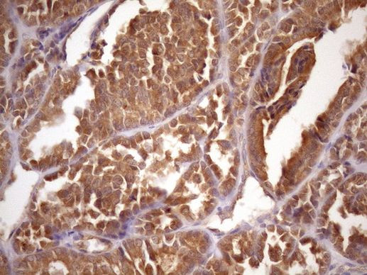 ASB2 Antibody in Immunohistochemistry (Paraffin) (IHC (P))