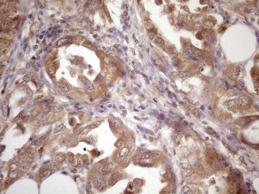 ASB2 Antibody in Immunohistochemistry (Paraffin) (IHC (P))