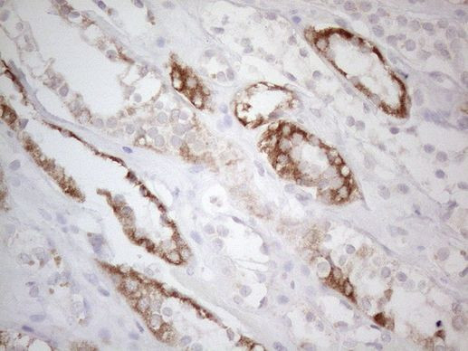 BTG2 Antibody in Immunohistochemistry (Paraffin) (IHC (P))