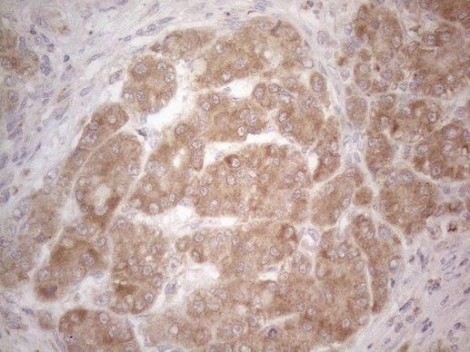 BTG2 Antibody in Immunohistochemistry (Paraffin) (IHC (P))