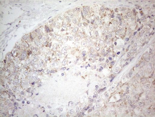 BTG2 Antibody in Immunohistochemistry (Paraffin) (IHC (P))