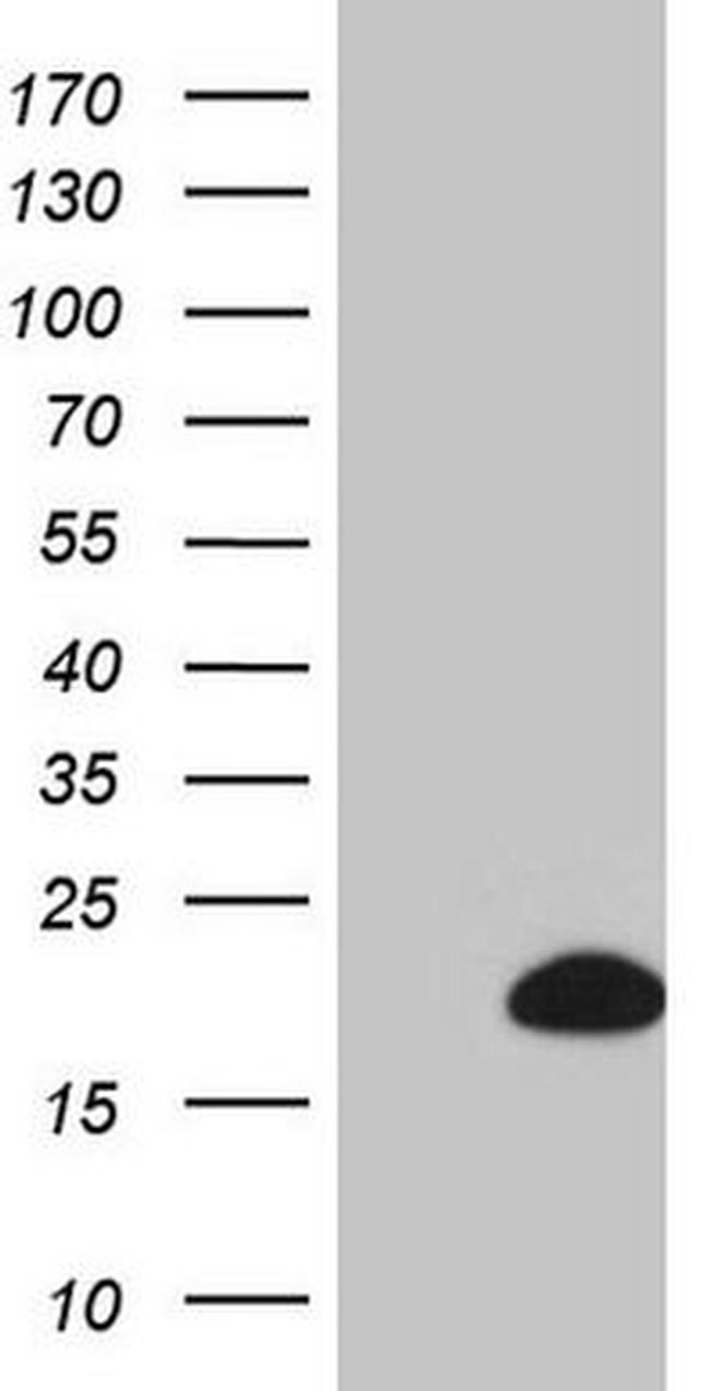 BTG2 Antibody in Western Blot (WB)