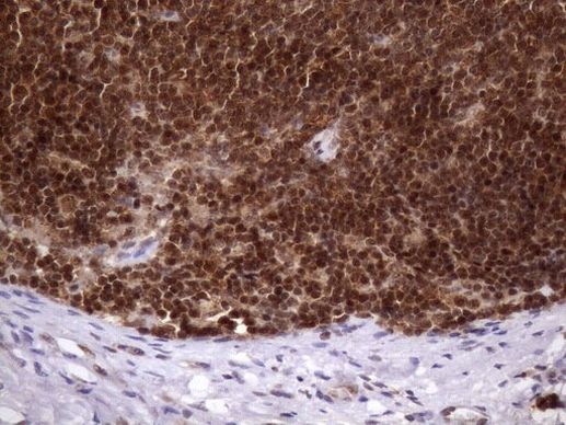 MGC12965 Antibody in Immunohistochemistry (Paraffin) (IHC (P))