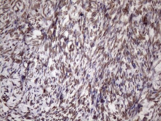 MGC12965 Antibody in Immunohistochemistry (Paraffin) (IHC (P))