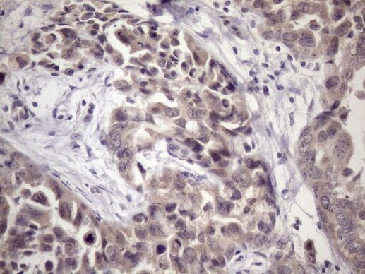 MGC12965 Antibody in Immunohistochemistry (Paraffin) (IHC (P))