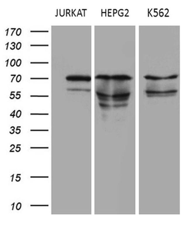 PIAS2 Antibody in Western Blot (WB)