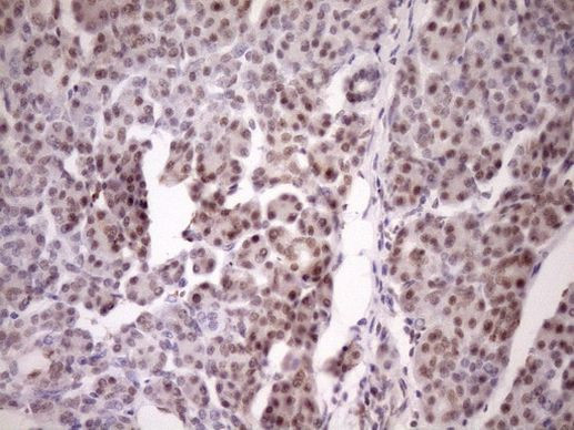 WTAP Antibody in Immunohistochemistry (Paraffin) (IHC (P))