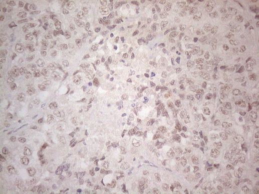 SPT3 Antibody in Immunohistochemistry (Paraffin) (IHC (P))