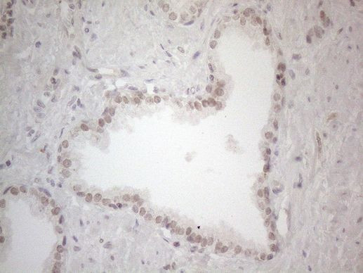 SPT3 Antibody in Immunohistochemistry (Paraffin) (IHC (P))