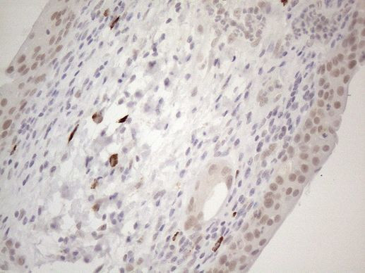 SPT3 Antibody in Immunohistochemistry (Paraffin) (IHC (P))