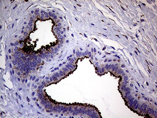 Melanophilin Antibody in Immunohistochemistry (Paraffin) (IHC (P))