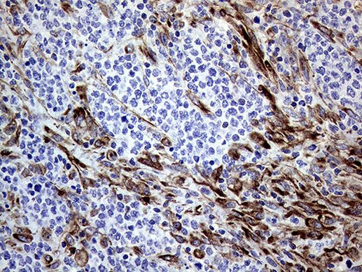 Melanophilin Antibody in Immunohistochemistry (Paraffin) (IHC (P))