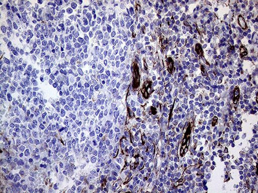 Melanophilin Antibody in Immunohistochemistry (Paraffin) (IHC (P))