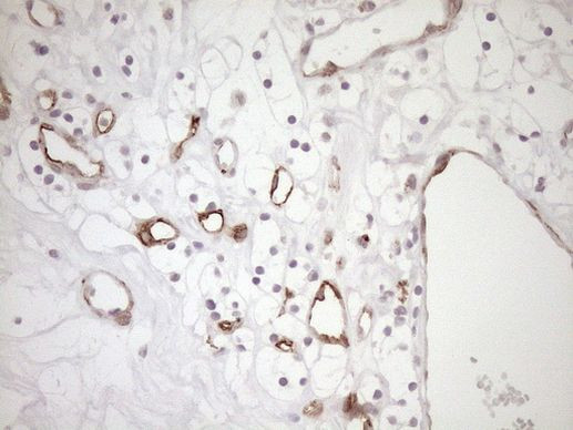 BLNK Antibody in Immunohistochemistry (Paraffin) (IHC (P))