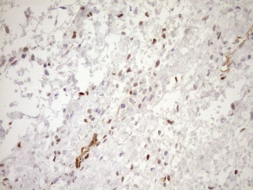 BLNK Antibody in Immunohistochemistry (Paraffin) (IHC (P))