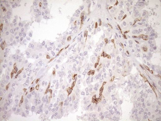 BLNK Antibody in Immunohistochemistry (Paraffin) (IHC (P))