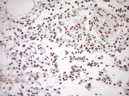 EXOSC1 Antibody in Immunohistochemistry (Paraffin) (IHC (P))