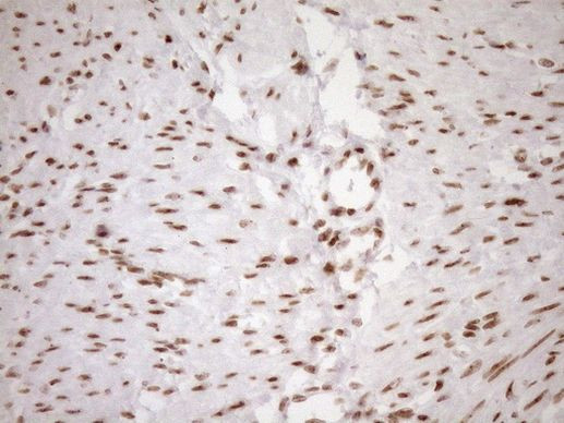 EXOSC1 Antibody in Immunohistochemistry (Paraffin) (IHC (P))