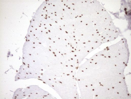 EXOSC1 Antibody in Immunohistochemistry (Paraffin) (IHC (P))