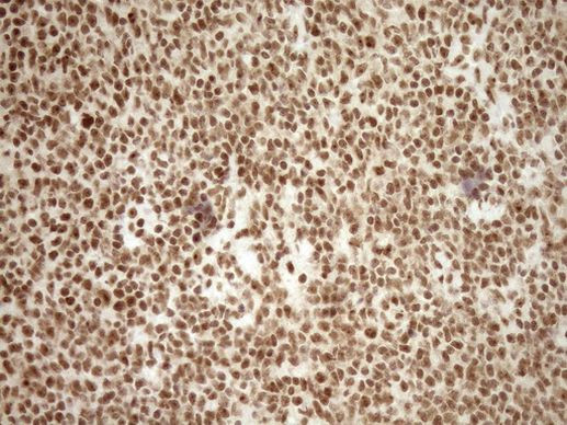 EXOSC1 Antibody in Immunohistochemistry (Paraffin) (IHC (P))