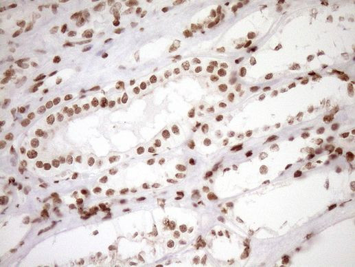 EXOSC1 Antibody in Immunohistochemistry (Paraffin) (IHC (P))