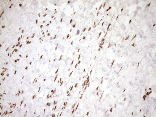 EXOSC1 Antibody in Immunohistochemistry (Paraffin) (IHC (P))