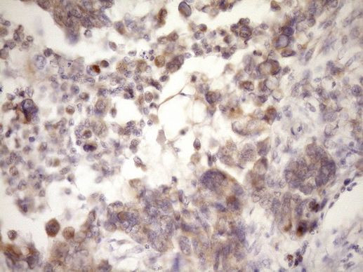 MCEE Antibody in Immunohistochemistry (Paraffin) (IHC (P))