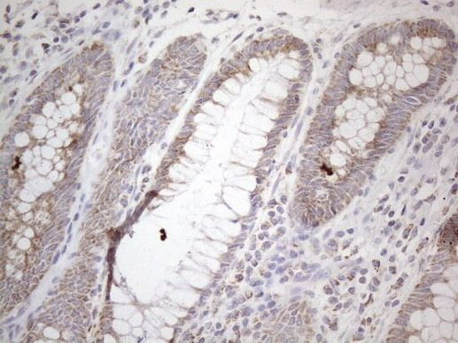 DLX4 Antibody in Immunohistochemistry (Paraffin) (IHC (P))