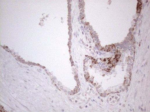 DLX4 Antibody in Immunohistochemistry (Paraffin) (IHC (P))