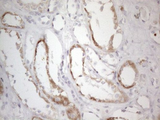 DLX4 Antibody in Immunohistochemistry (Paraffin) (IHC (P))