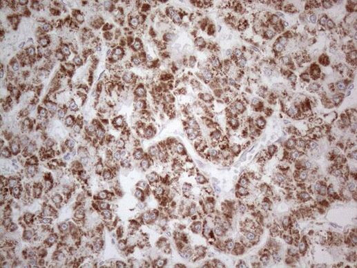 DLX4 Antibody in Immunohistochemistry (Paraffin) (IHC (P))