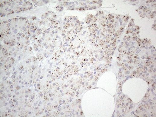 DLX4 Antibody in Immunohistochemistry (Paraffin) (IHC (P))