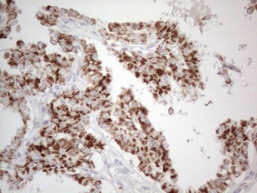 DLX4 Antibody in Immunohistochemistry (Paraffin) (IHC (P))