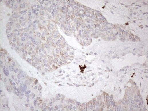 DLX4 Antibody in Immunohistochemistry (Paraffin) (IHC (P))