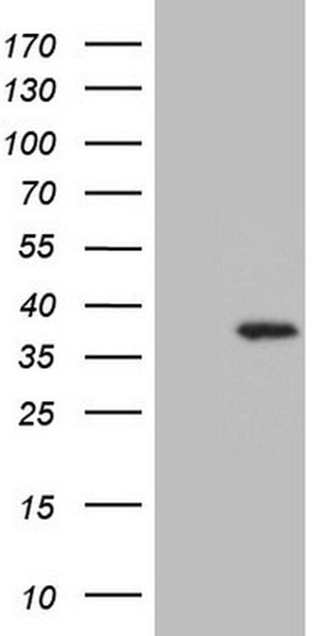 UTP11L Antibody in Western Blot (WB)