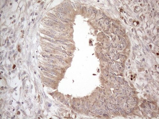 AMTN Antibody in Immunohistochemistry (Paraffin) (IHC (P))