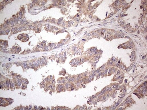 AMTN Antibody in Immunohistochemistry (Paraffin) (IHC (P))