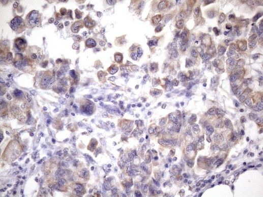 PHD1 Antibody in Immunohistochemistry (Paraffin) (IHC (P))