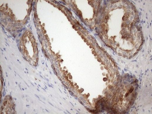 PHD1 Antibody in Immunohistochemistry (Paraffin) (IHC (P))