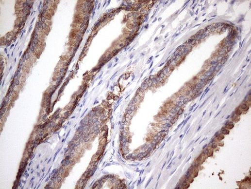 PHD1 Antibody in Immunohistochemistry (Paraffin) (IHC (P))