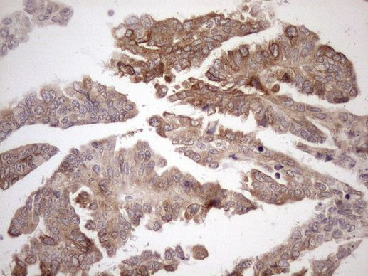 Aladin Antibody in Immunohistochemistry (Paraffin) (IHC (P))