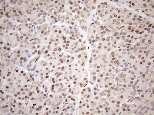 Aladin Antibody in Immunohistochemistry (Paraffin) (IHC (P))