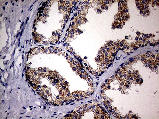 MAK Antibody in Immunohistochemistry (Paraffin) (IHC (P))